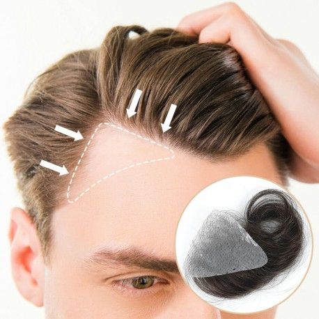 Hair Patch Treatment